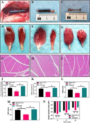 Ti3C2Tx MXene-Coated Electrospun PCL Conduits for Enhancing Neurite Regeneration and Angiogenesis